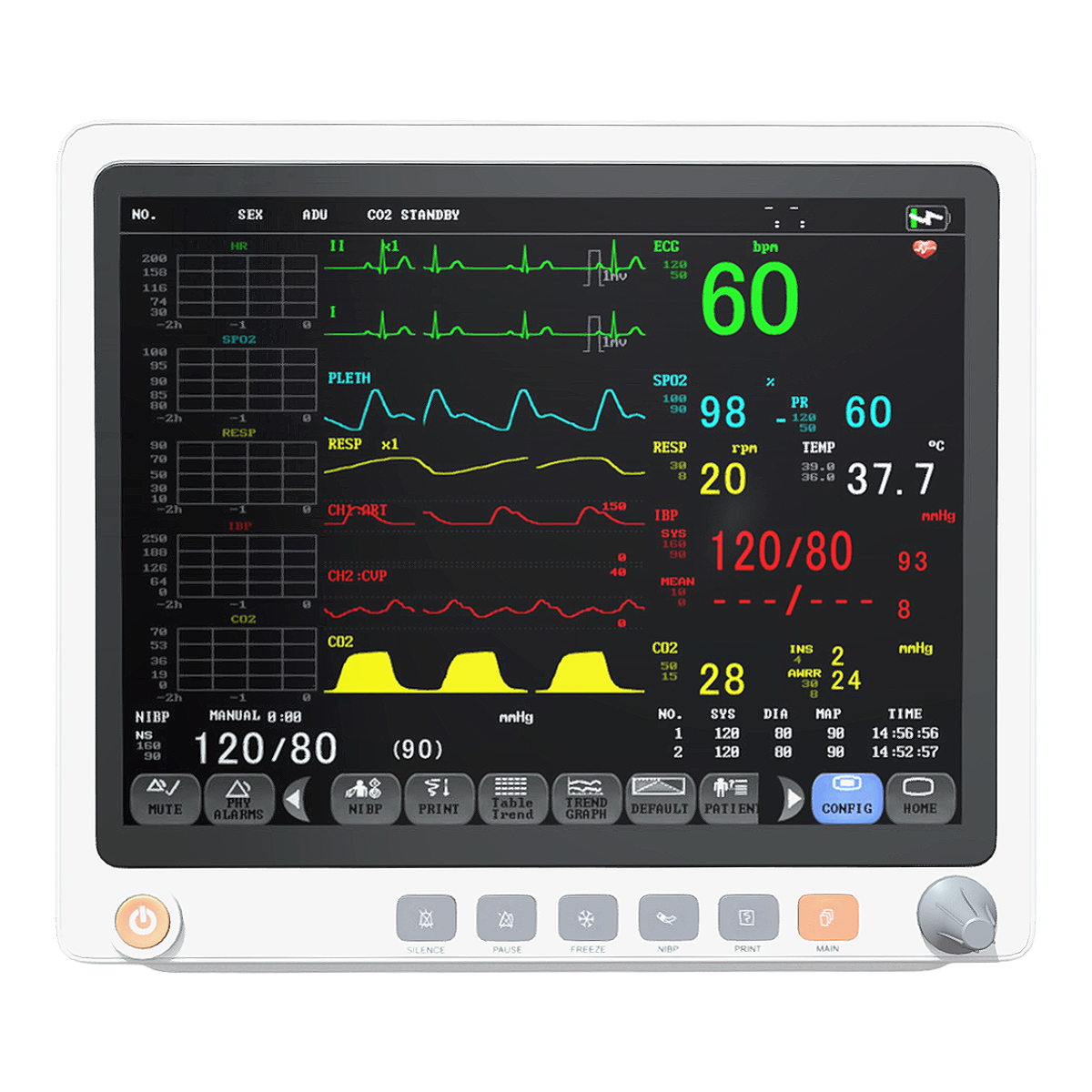 医用多参数病人心电图监护仪 | 医疗器械,多参数病人监护仪,医用监护仪,多功能监护仪,便携式心电监护仪,心电图监护仪,Ⅱ类医疗器械,无创监护仪器,血压监护仪,血氧饱和度监护仪,3D模型,3D打印,3D素材,obj,glTF,fbx,dae,stl,3ds,glb,usdz,3dmax,blender模型,VisionPro,3D建模,3D扫描,3d打印模型